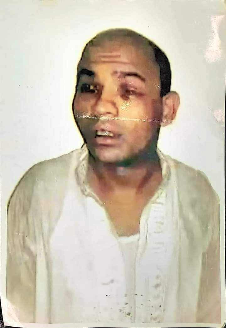 শিকলে বাঁধা গণমাধ্যম দিবস নির্যাতিত সাংবাদিকের আহাজারি