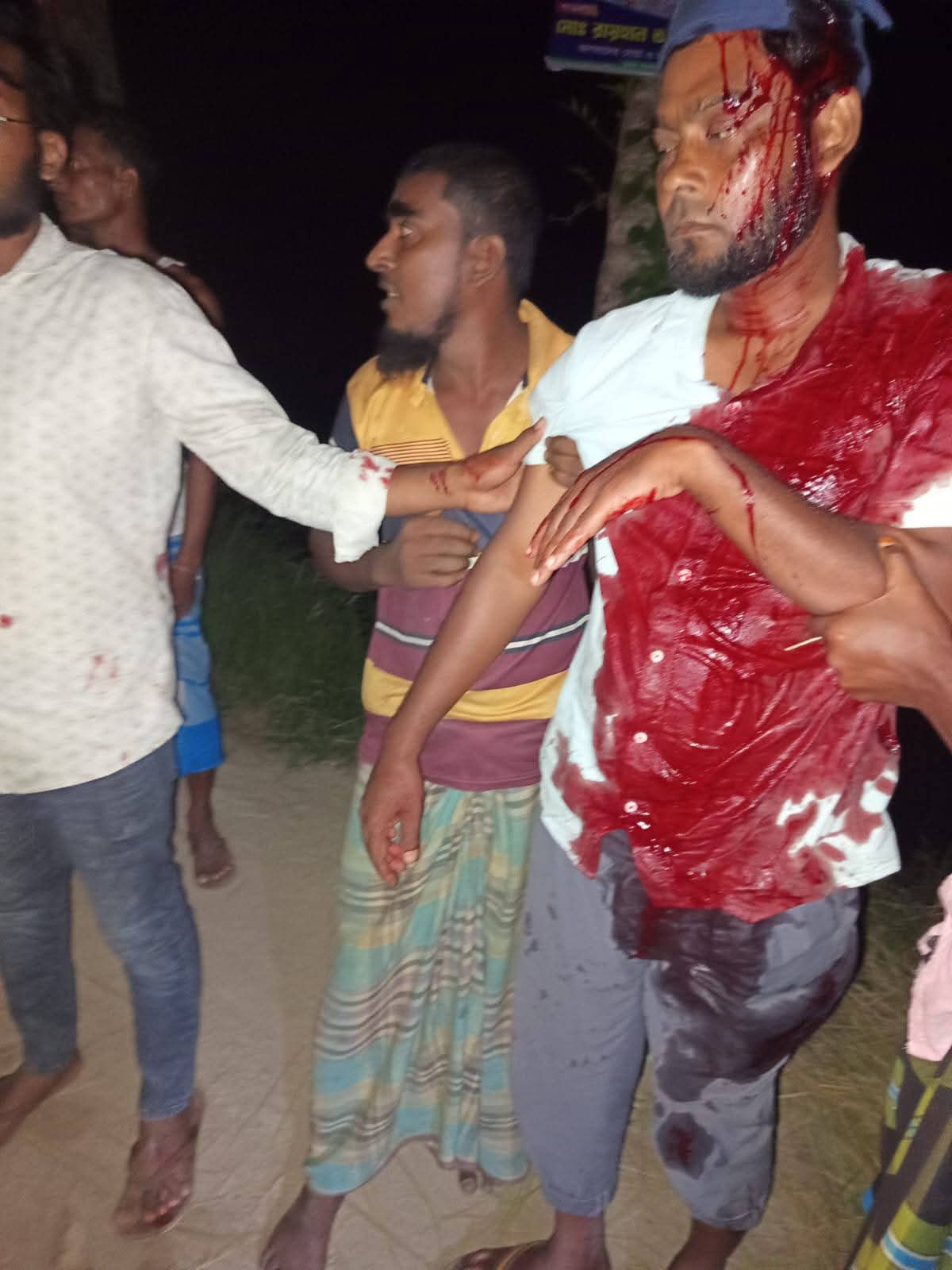 ভাঙ্গুড়ায় জামায়াত নেতা কুপিয়ে হত্যাচেষ্টার অভিযোগ, থানা ঘেরাও ও বিক্ষোভ